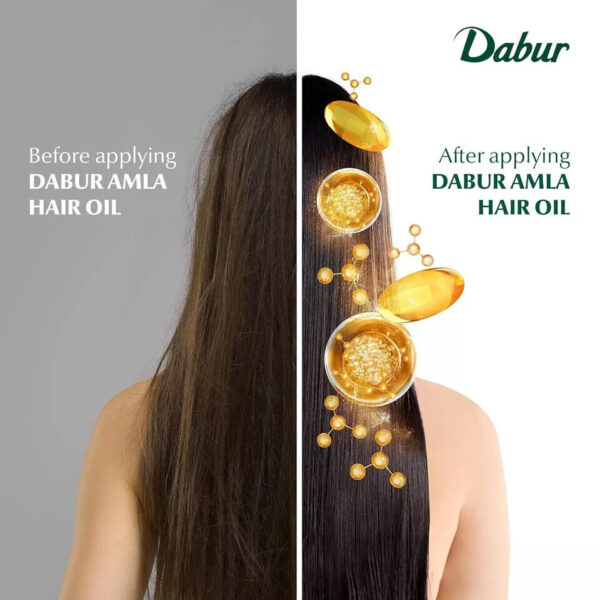 Amla bs before after